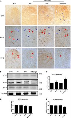 Endothelin-1, over-expressed in SOD1G93A mice, aggravates injury of NSC34-hSOD1G93A cells through complicated molecular mechanism revealed by quantitative proteomics analysis